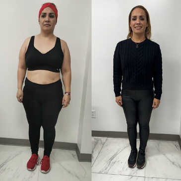 Slider image (3) Obesity Out Bariatric Surgery Center